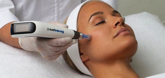 zabieg przy użyciu Dermapen 4
