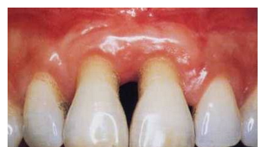 periodontologia